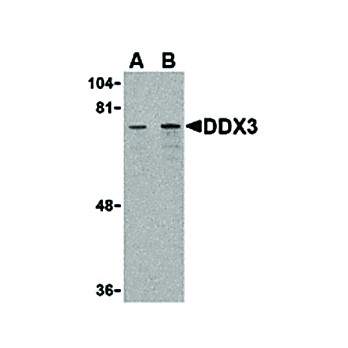 DDX3 Antibody internal 100µg