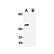 CRTH2 Antibody nterm 100µg