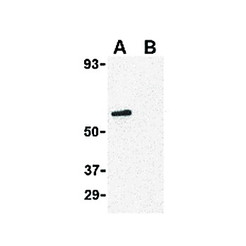 CRTH2 Antibody nterm 100µg