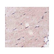 FNIP2 Antibody cterm 100µg