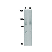 JPH4 Antibody cterm 100µg