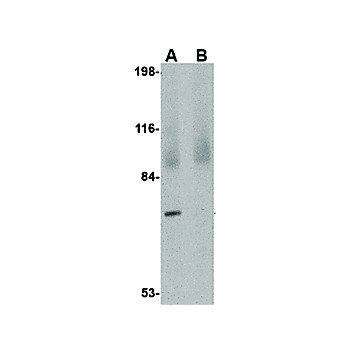 JPH4 Antibody cterm 100µg