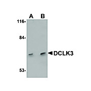 Anti-DCLK3 (RABBIT) Antibody, 100µg, Liquid (sterile filtered)