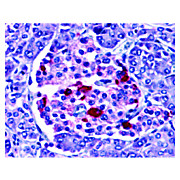 Anti-EndoG (RABBIT) Antibody, 100µg, Liquid (sterile filtered)
