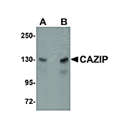 Anti-CAZIP (RABBIT) Antibody, 100µg, Liquid (sterile filtered)