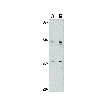 FEZ2 Antibody internal 100µg