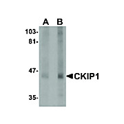 Anti-CKIP1 (RABBIT) Antibody, 100µg, Liquid (sterile filtered)