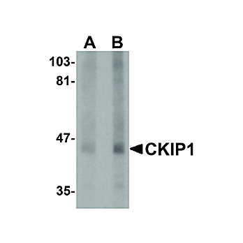 Anti-CKIP1 (RABBIT) Antibody, 100µg, Liquid (sterile filtered)