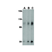 GRIK2 Antibody 100µg