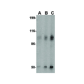 GRIK2 Antibody 100µg