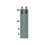 IL-17 Antibody nterm 100µg
