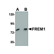 Anti-FREM1 (RABBIT) Antibody, 100µg, Liquid (sterile filtered)