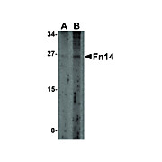 Anti-FN14 (RABBIT) Antibody, 100µg, Liquid (sterile filtered)
