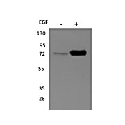 Anti-p90 RSK1 (RABBIT) Antibody, 25µL, Liquid (sterile filtered)