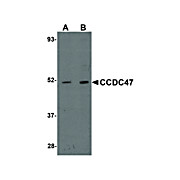 CCDC47 Antibody 100µg