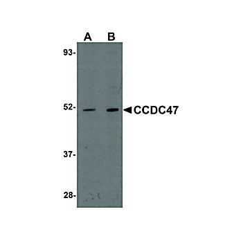 CCDC47 Antibody 100µg