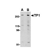 Anti-Telomerase Associated Protein 1 (TEP1) (RABBIT) Antibody, 100µg, Liquid (sterile filtered)