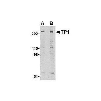 Anti-Telomerase Associated Protein 1 (TEP1) (RABBIT) Antibody, 100µg, Liquid (sterile filtered)