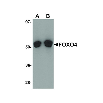 FOXO4 Antibody 100µg