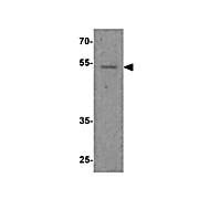Anti-FOXG1 (RABBIT) Antibody, 100µg, Liquid (sterile filtered)