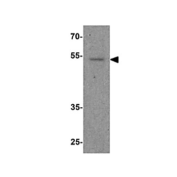 Anti-FOXG1 (RABBIT) Antibody, 100µg, Liquid (sterile filtered)