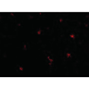 FEZ2 Antibody cterm 100µg