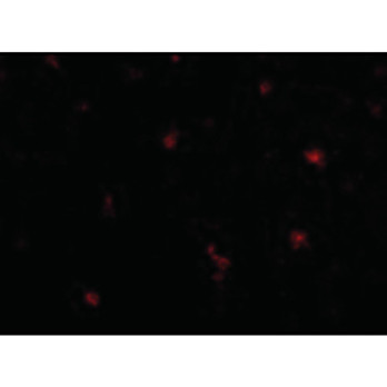 FEZ2 Antibody cterm 100µg