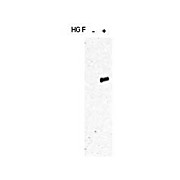 Anti-c-MET pY1349 pY1356 (RABBIT) Antibody, 100µg, Liquid (sterile filtered)