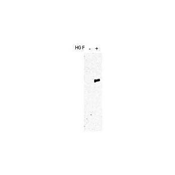 Anti-c-MET pY1349 pY1356 (RABBIT) Antibody, 100µg, Liquid (sterile filtered)