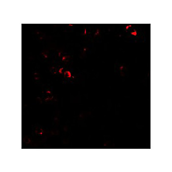 Anti-E2F3 (RABBIT) Antibody, 100µg, Liquid (sterile filtered)