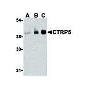 CTRP5 Antibody nterm 100µg