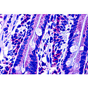 DISP2 Antibody nterm 100µg