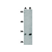 Anti-Hax1b (RABBIT) Antibody, 100µg, Liquid (sterile filtered)