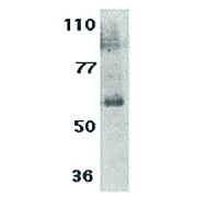IL-21 Receptor Antibody (internal) 100µg