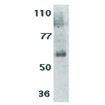 IL-21 Receptor Antibody (internal) 100µg