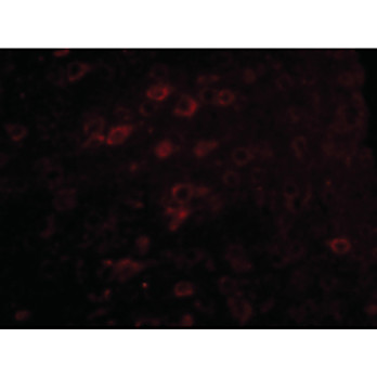 Anti-LASS6 (RABBIT) Antibody, 100µg, Liquid (sterile filtered)