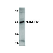 Anti-JMJD7 (RABBIT) Antibody, 100µg, Liquid (sterile filtered)
