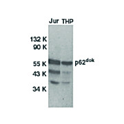 Anti-DOK1 (RABBIT) Antibody, 100µg, Liquid (sterile filtered)