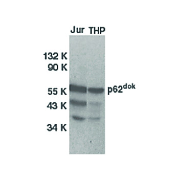 Anti-DOK1 (RABBIT) Antibody, 100µg, Liquid (sterile filtered)