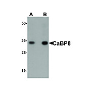 Anti-CaBP8 (RABBIT) Antibody, 100µg, Liquid (sterile filtered)