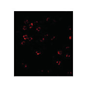 DISC1 Antibody internal 100µg