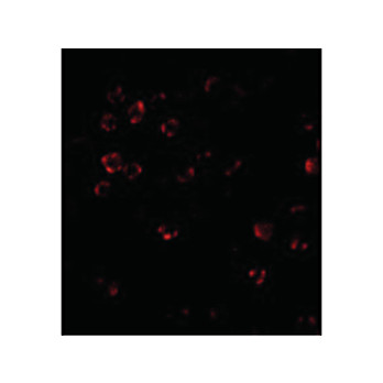 DISC1 Antibody internal 100µg