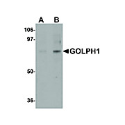 Anti-GOLPH1 (RABBIT) Antibody, 100µg, Liquid (sterile filtered)