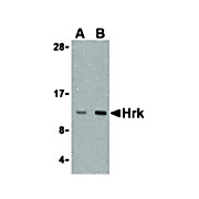 Anti-HRK (RABBIT) Antibody, 100µg, Liquid (sterile filtered)