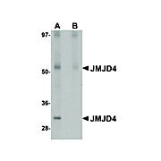 Anti-JMJD4 (RABBIT) Antibody, 100µg, Liquid (sterile filtered)