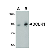 Anti-DCLK1 (RABBIT) Antibody, 100µg, Liquid (sterile filtered)