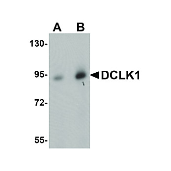 Anti-DCLK1 (RABBIT) Antibody, 100µg, Liquid (sterile filtered)