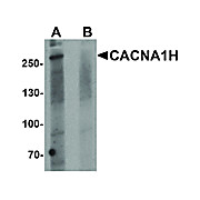 Anti-CACNA1H (RABBIT) Antibody, 100µg, Liquid (sterile filtered)