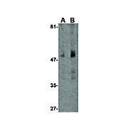 Carabin nterm Antibody 100µg