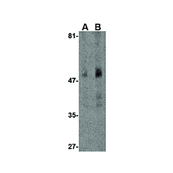 Carabin nterm Antibody 100µg